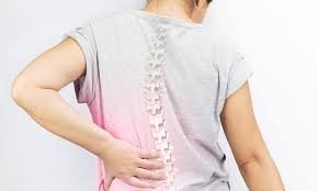 Scoliosis